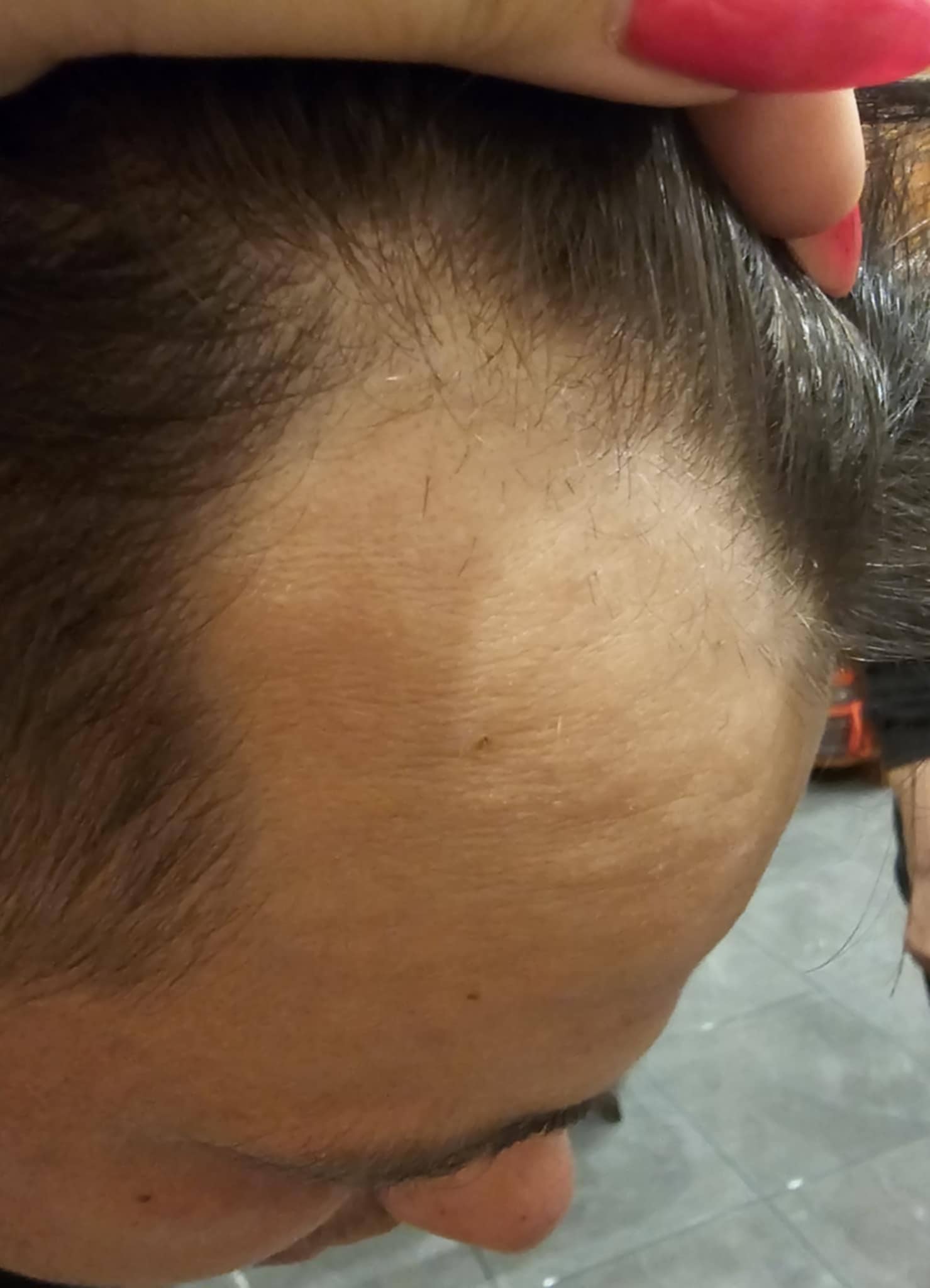 efekt przed wcierką